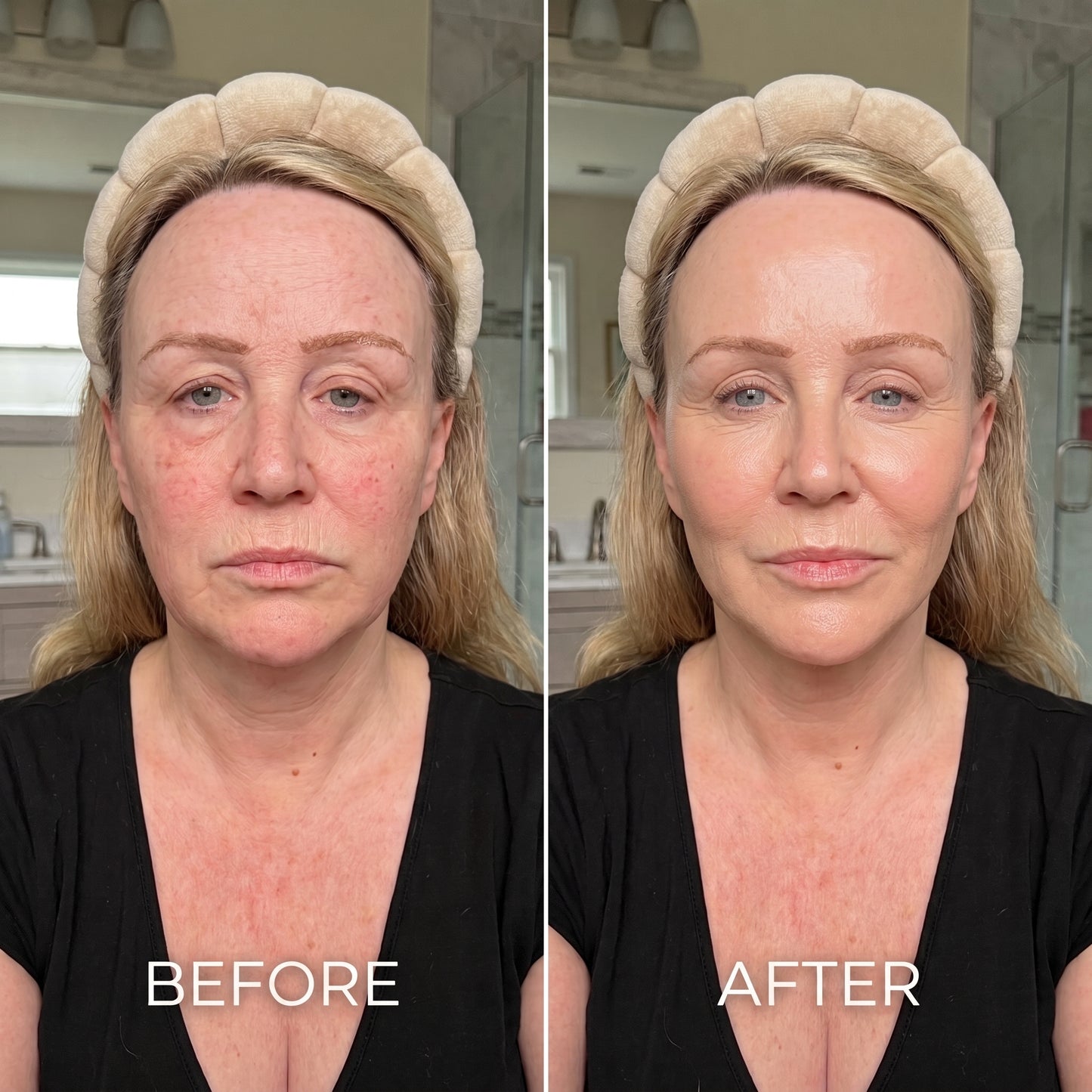 Lymphatic Drainage Brush
