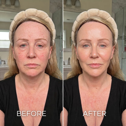 Lymphatic Drainage Brush